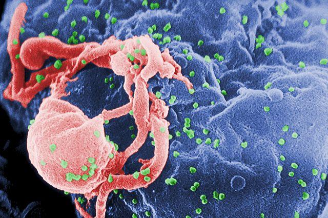 HIV-1病毒从培养的淋巴细胞中释放